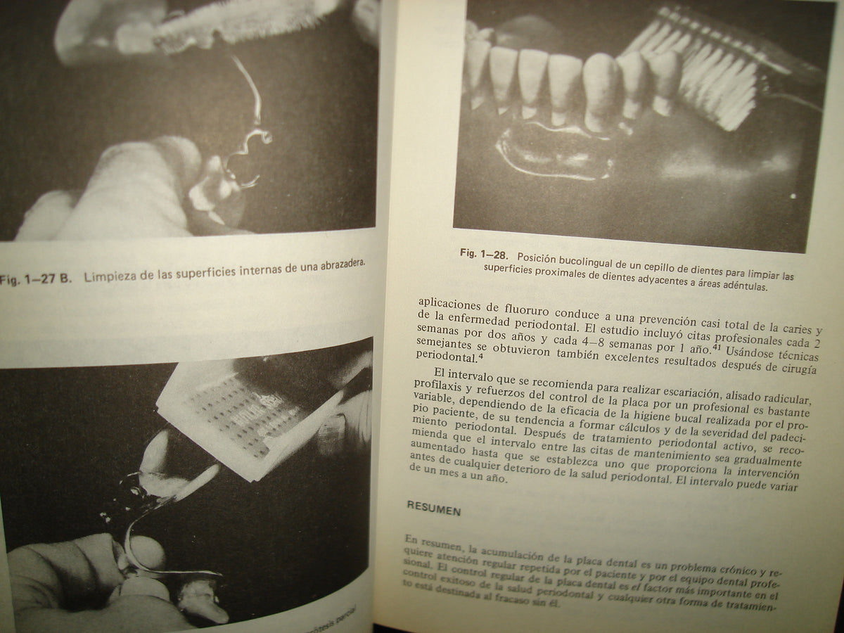 161- Manejo De Tejidos En Odontología Restaurativa - William F. P. Malone