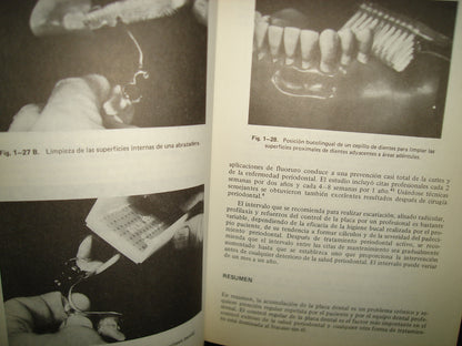 161- Manejo De Tejidos En Odontología Restaurativa - William F. P. Malone