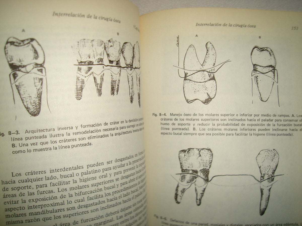 161- Manejo De Tejidos En Odontología Restaurativa - William F. P. Malone