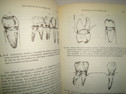 161- Manejo De Tejidos En Odontología Restaurativa - William F. P. Malone