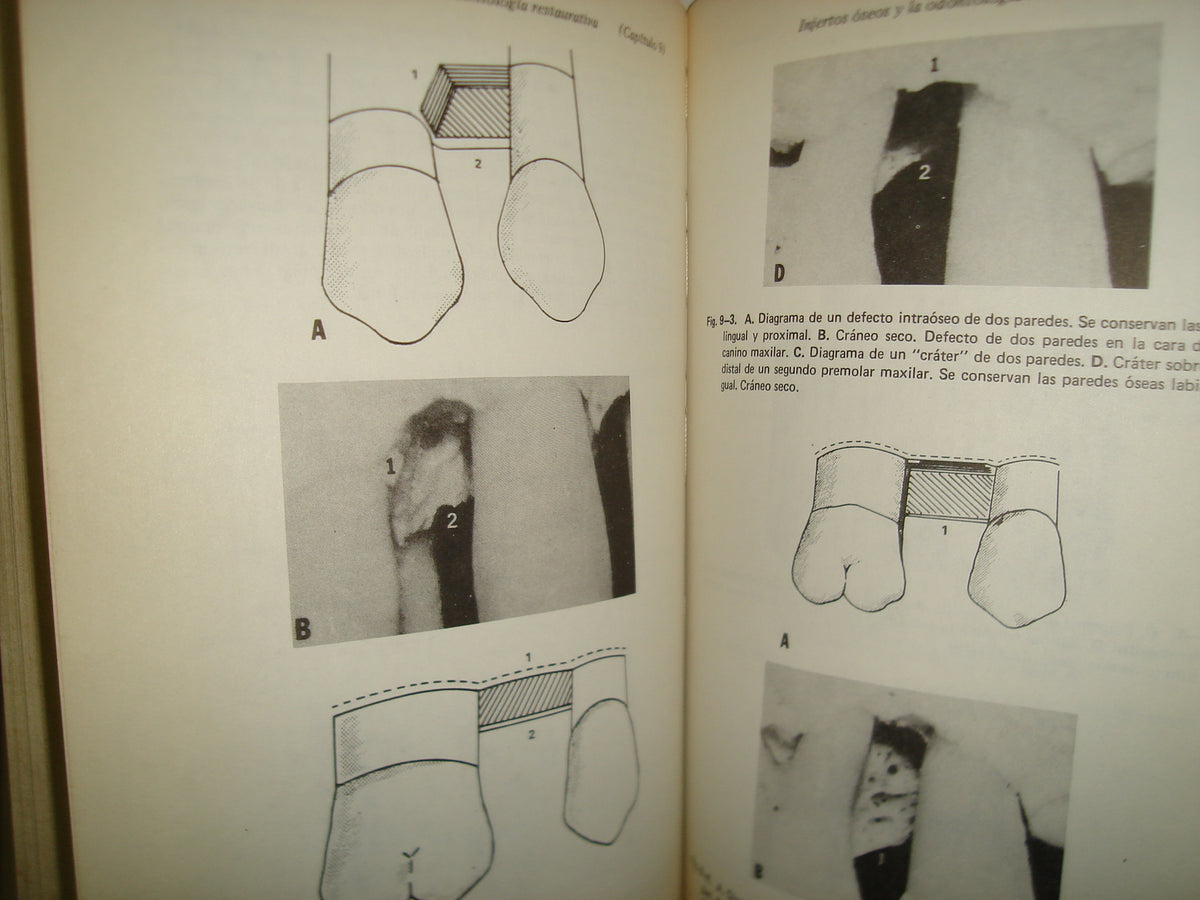161- Manejo De Tejidos En Odontología Restaurativa - William F. P. Malone