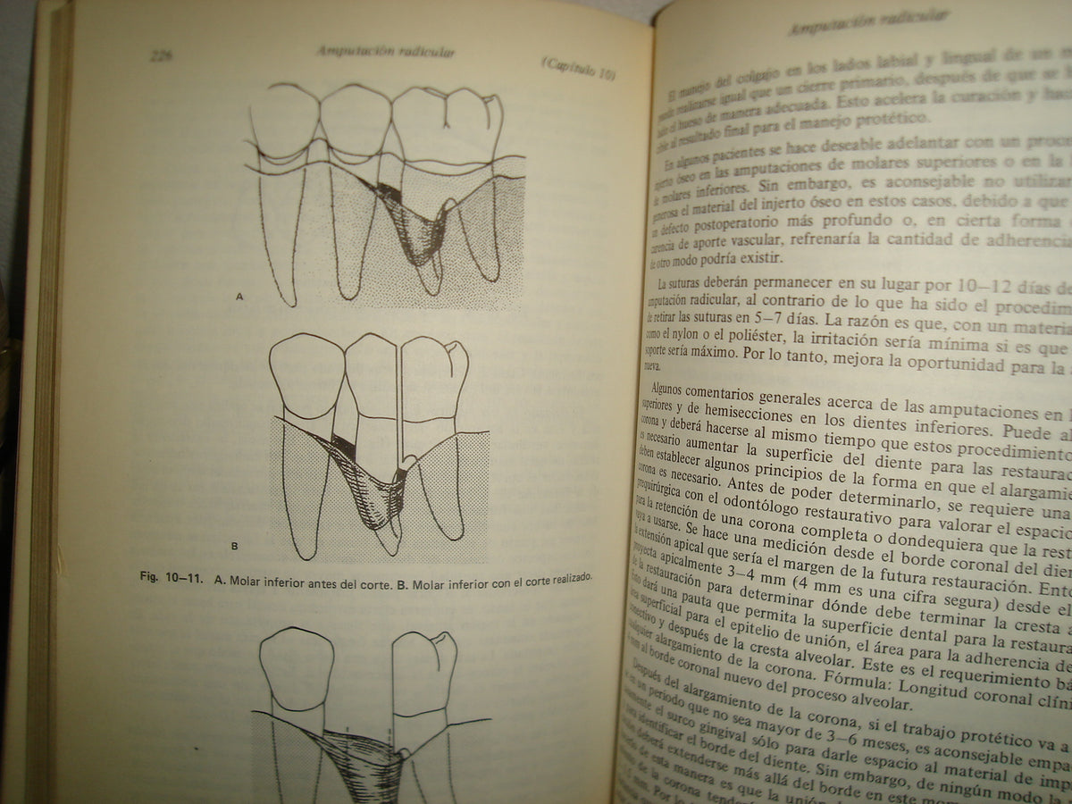 161- Manejo De Tejidos En Odontología Restaurativa - William F. P. Malone