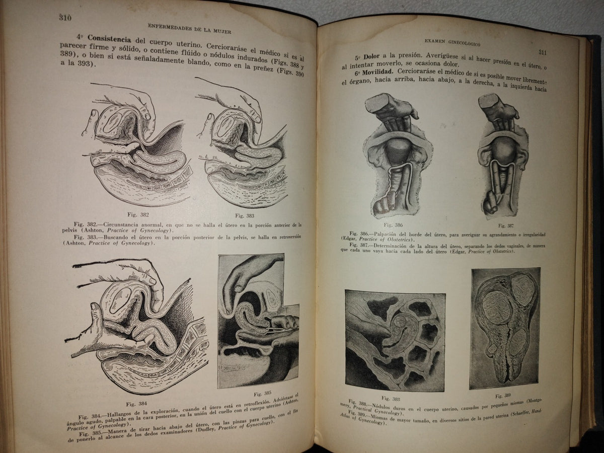 151- Enfermedades De La Mujer - Harry Sturgeon Crossen - Uteha 1939