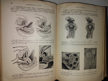 151- Enfermedades De La Mujer - Harry Sturgeon Crossen - Uteha 1939