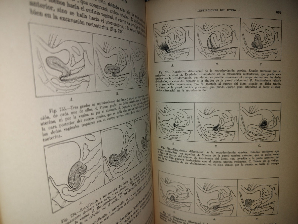 151- Enfermedades De La Mujer - Harry Sturgeon Crossen - Uteha 1939