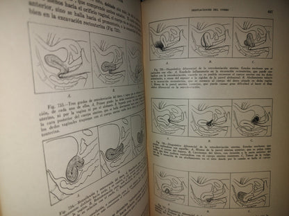 151- Enfermedades De La Mujer - Harry Sturgeon Crossen - Uteha 1939
