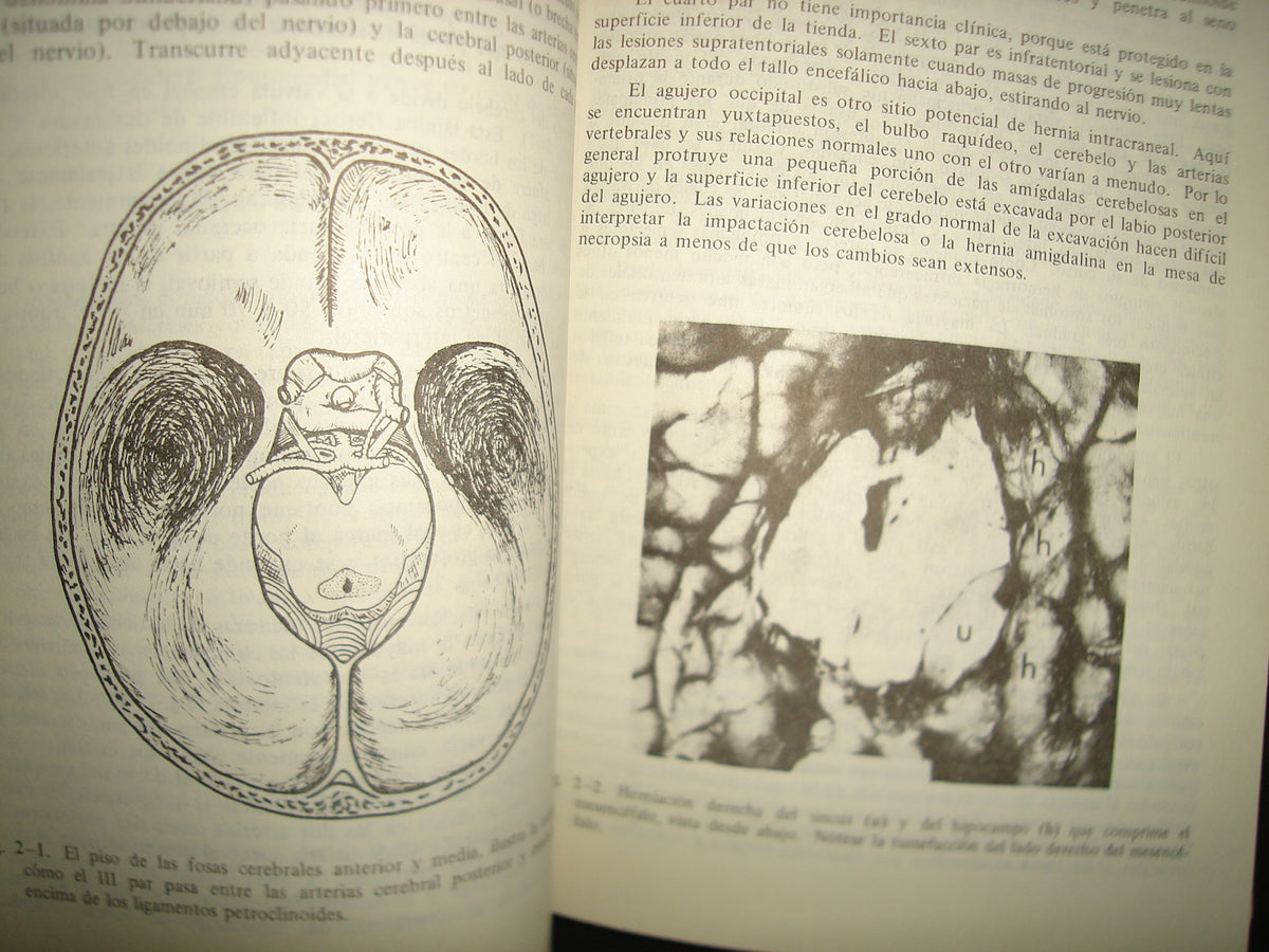 10- Lo Esencial Del Estupor Y Coma - Fred Plum, Jerome B. Posner