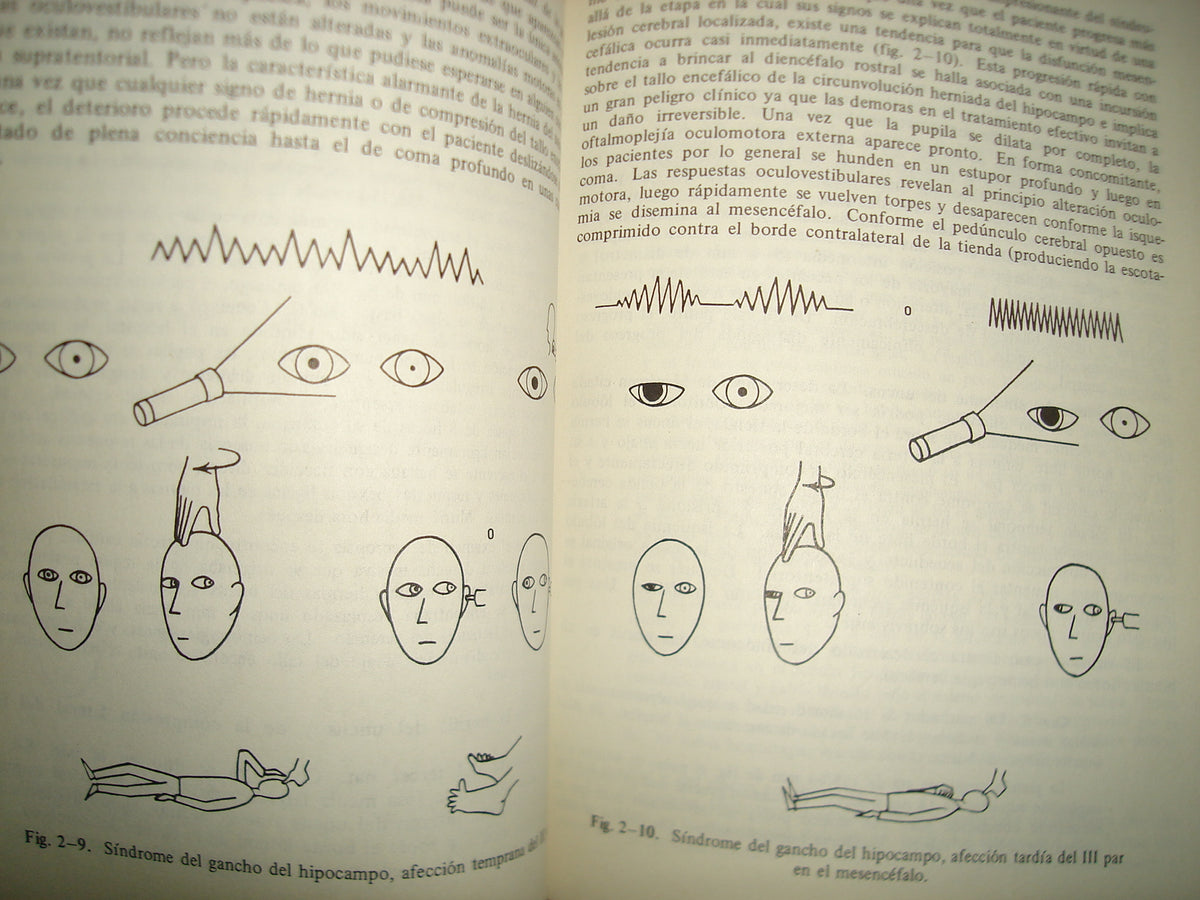 10- Lo Esencial Del Estupor Y Coma - Fred Plum, Jerome B. Posner