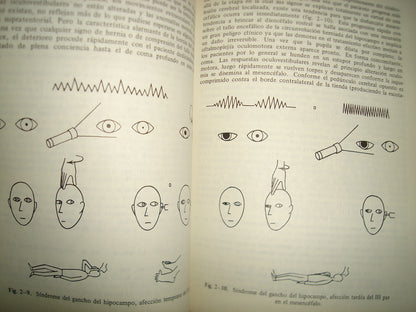 10- Lo Esencial Del Estupor Y Coma - Fred Plum, Jerome B. Posner
