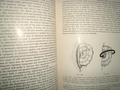 160- Enfermedades Del Colon / Diseases Of The Colon And Anorrectum. Vol. Two -Robert Turell - W. B. Saunders Company, 1959