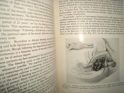 160- Enfermedades Del Colon / Diseases Of The Colon And Anorrectum. Vol. Two -Robert Turell - W. B. Saunders Company, 1959