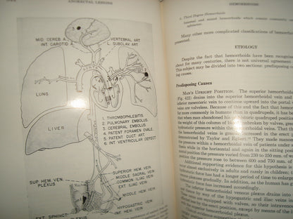 160- Enfermedades Del Colon / Diseases Of The Colon And Anorrectum. Vol. Two -Robert Turell - W. B. Saunders Company, 1959