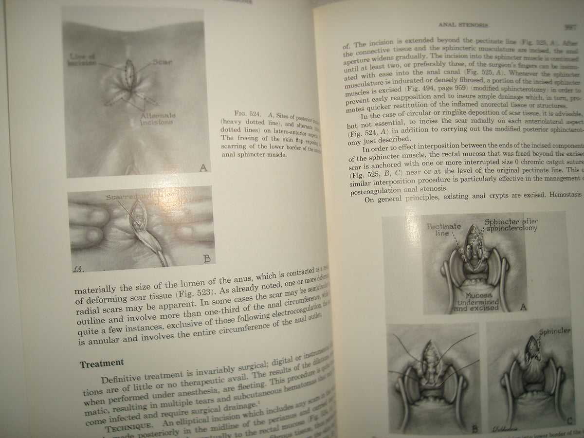 160- Enfermedades Del Colon / Diseases Of The Colon And Anorrectum. Vol. Two -Robert Turell - W. B. Saunders Company, 1959