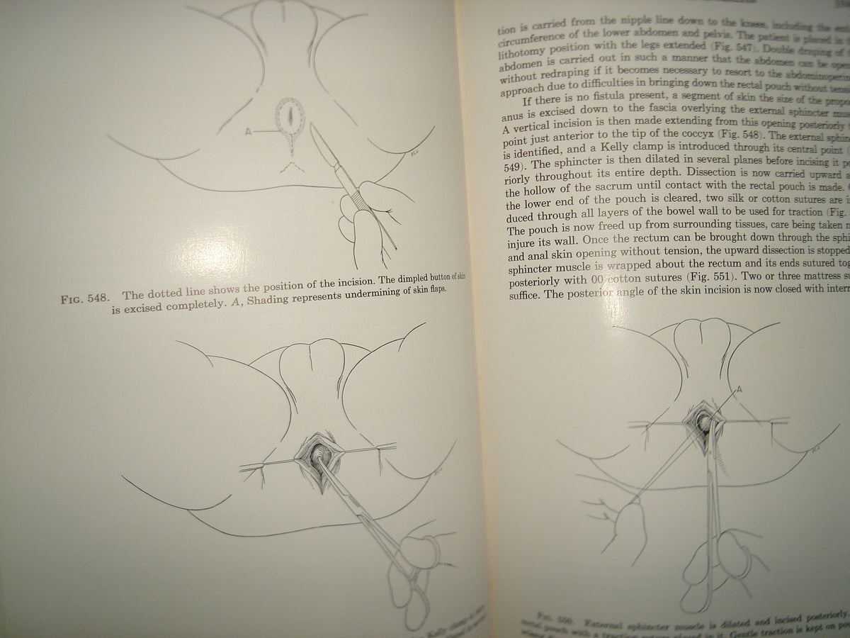 160- Enfermedades Del Colon / Diseases Of The Colon And Anorrectum. Vol. Two -Robert Turell - W. B. Saunders Company, 1959
