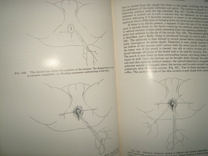 160- Enfermedades Del Colon / Diseases Of The Colon And Anorrectum. Vol. Two -Robert Turell - W. B. Saunders Company, 1959