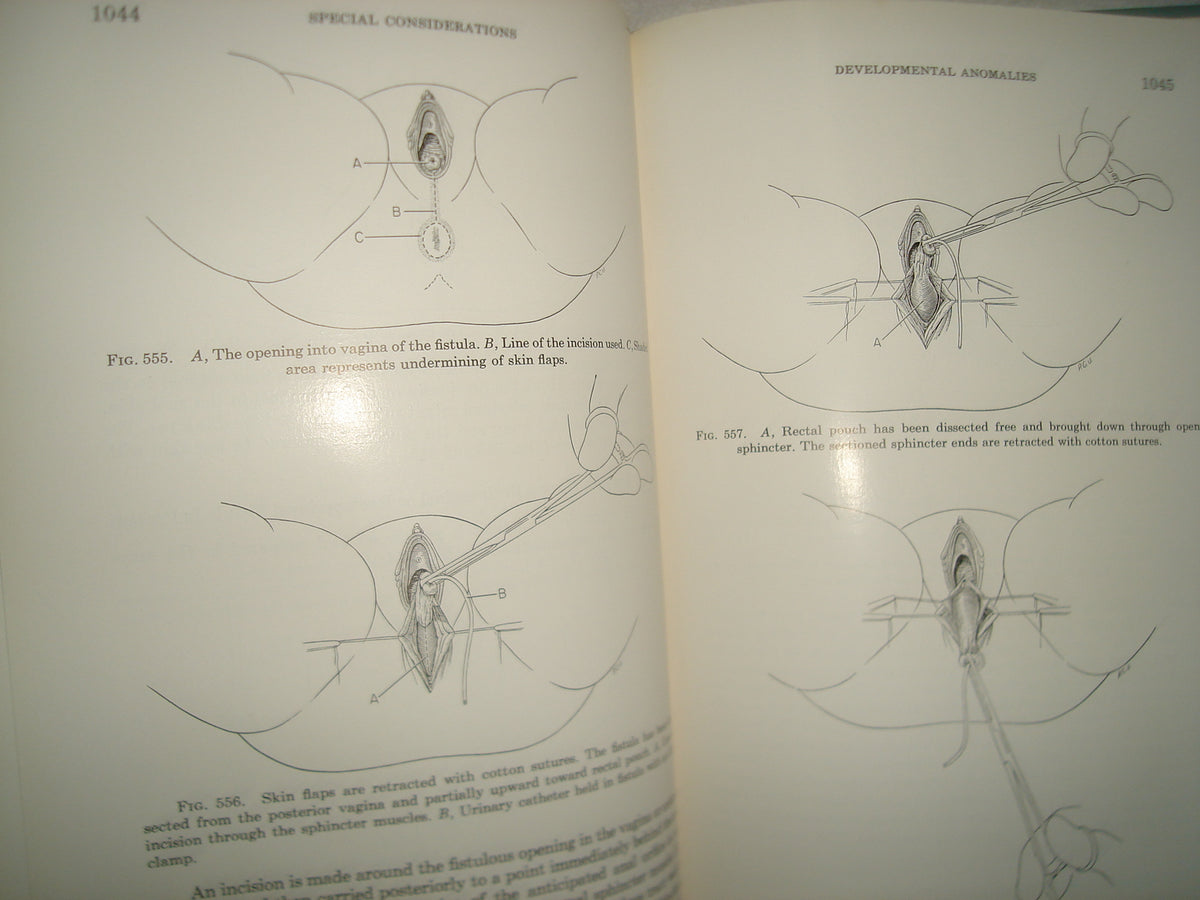160- Enfermedades Del Colon / Diseases Of The Colon And Anorrectum. Vol. Two -Robert Turell - W. B. Saunders Company, 1959