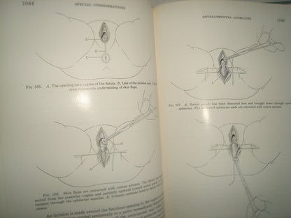 160- Enfermedades Del Colon / Diseases Of The Colon And Anorrectum. Vol. Two -Robert Turell - W. B. Saunders Company, 1959