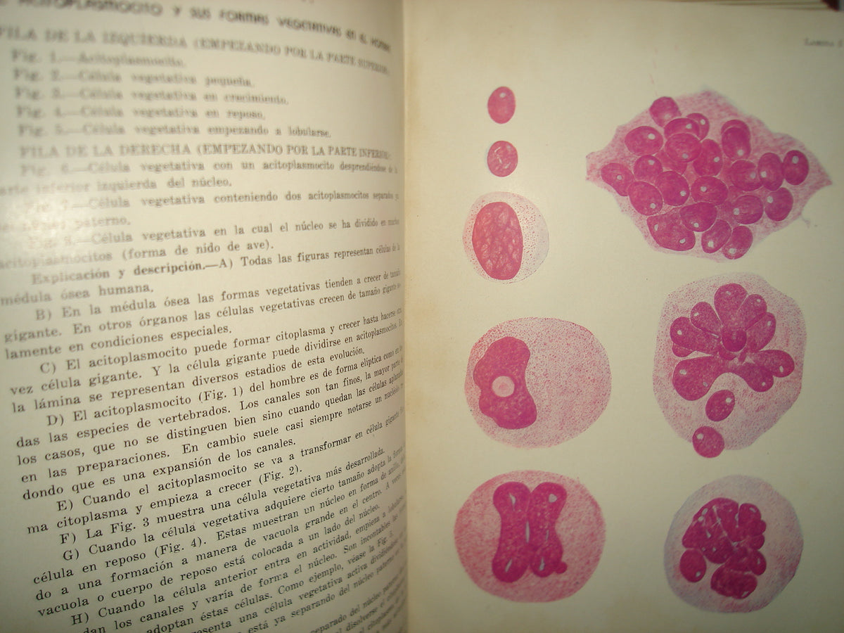 160- Hematología Clínica Basada En La Doctrina Del Acitoplasmocito Y Células Vegetativas - 1941