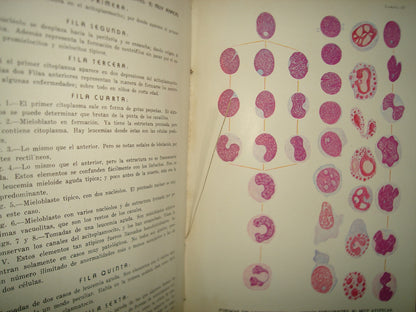160- Hematología Clínica Basada En La Doctrina Del Acitoplasmocito Y Células Vegetativas - 1941