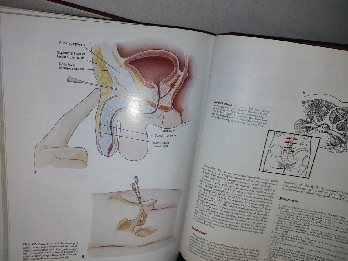 179- Anesthesia. Fifth Edition. Volume 1 And 2 - Ronald D. Miller - 1981