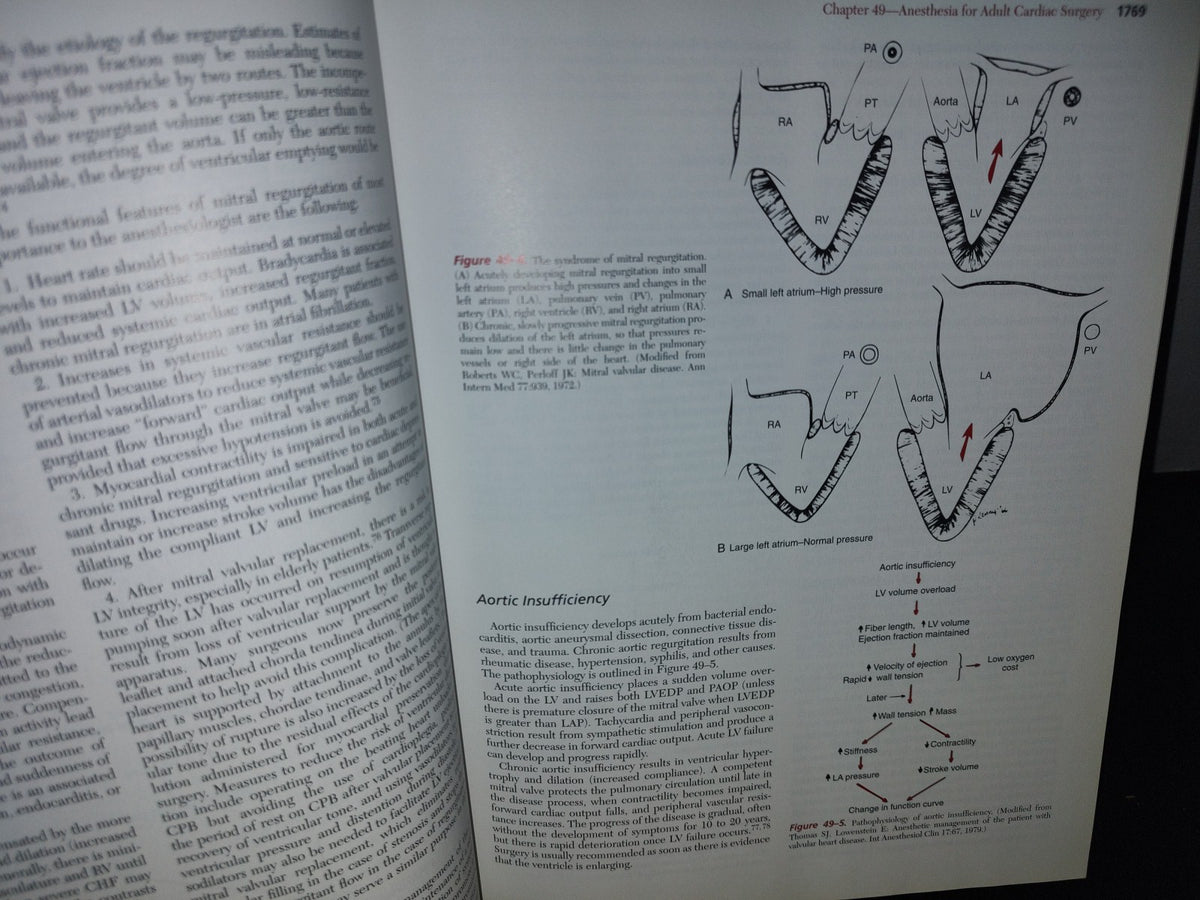 179- Anesthesia. Fifth Edition. Volume 1 And 2 - Ronald D. Miller - 1981