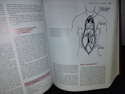 179- Anesthesia. Fifth Edition. Volume 1 And 2 - Ronald D. Miller - 1981