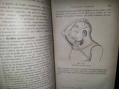 59- Francés. Compendio De Patología / Précis De Pathologie Externe - E. Forgue - 1906
