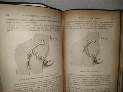 59- Francés. Compendio De Patología / Précis De Pathologie Externe - E. Forgue - 1906