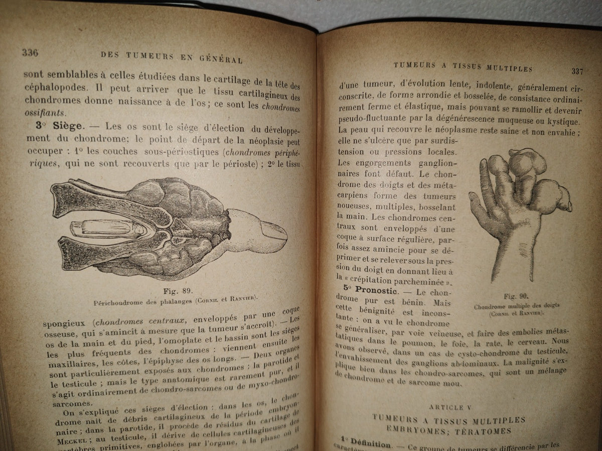 59- Francés. Compendio De Patología / Précis De Pathologie Externe - E. Forgue - 1906