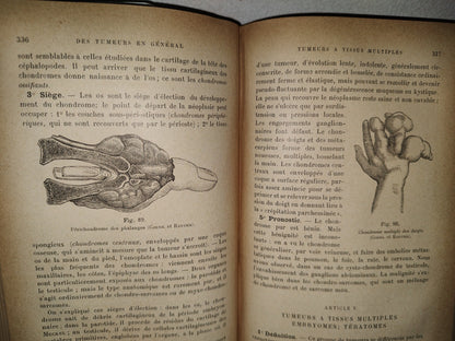 59- Francés. Compendio De Patología / Précis De Pathologie Externe - E. Forgue - 1906