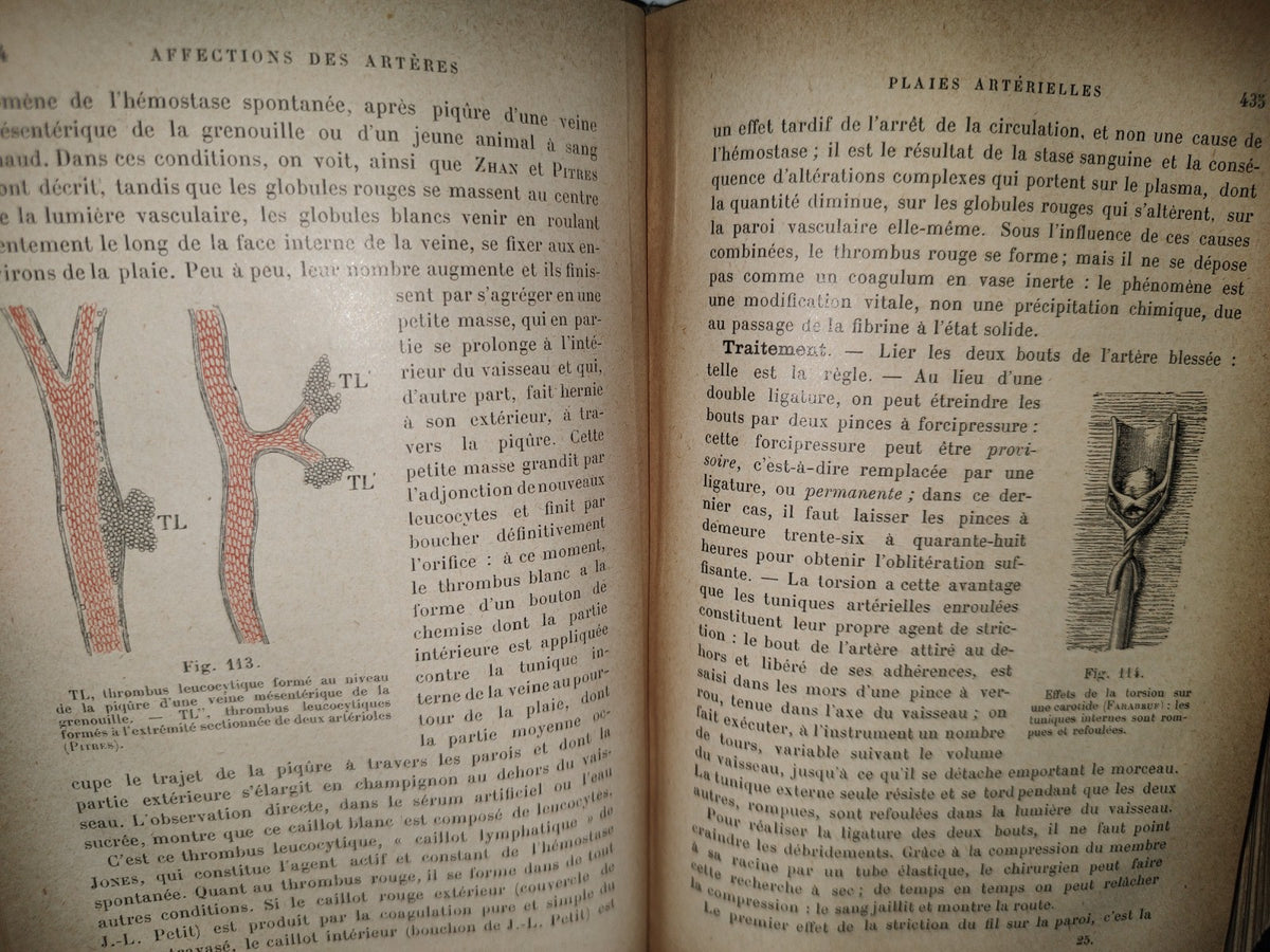 59- Francés. Compendio De Patología / Précis De Pathologie Externe - E. Forgue - 1906