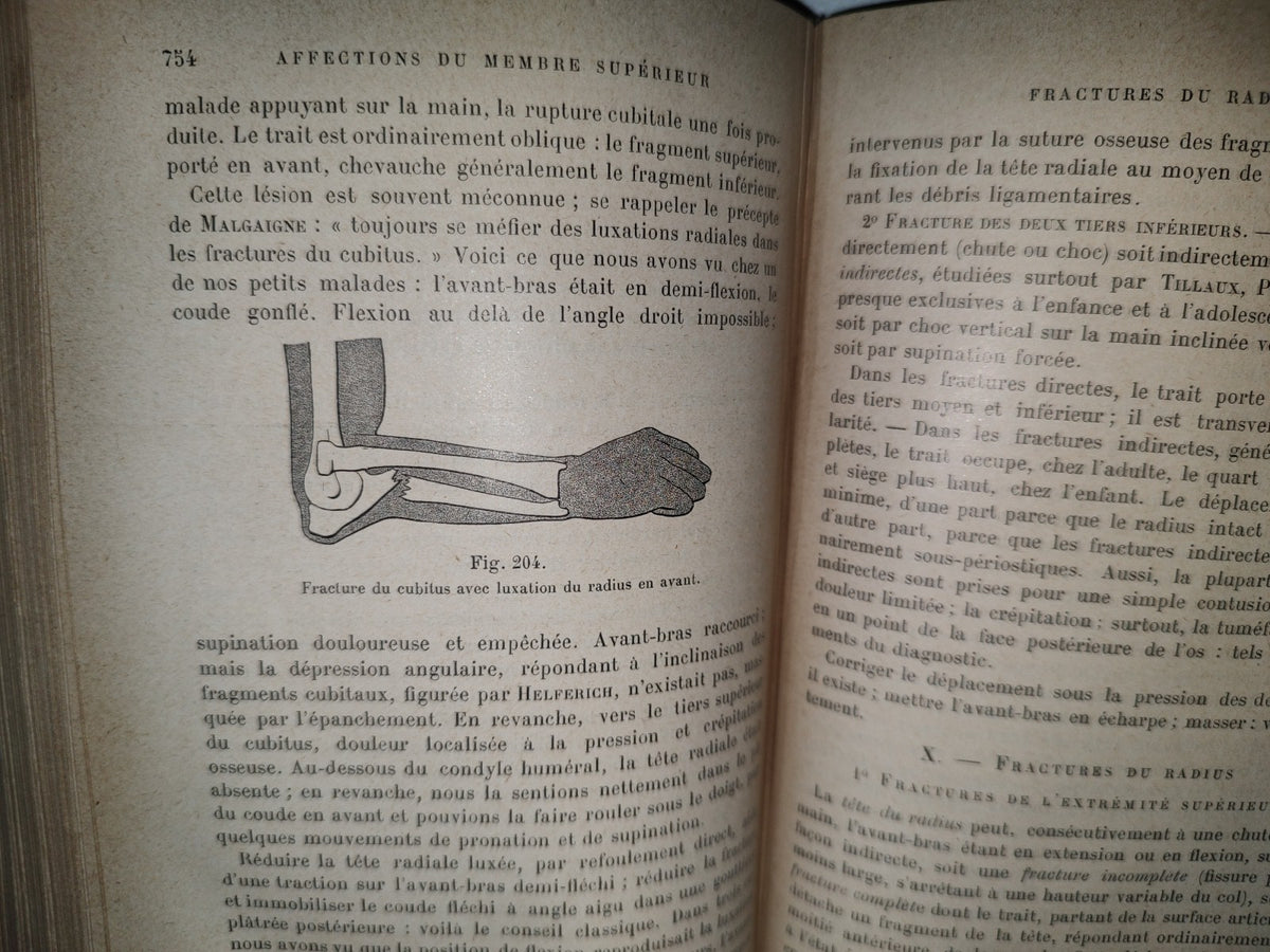 59- Francés. Compendio De Patología / Précis De Pathologie Externe - E. Forgue - 1906