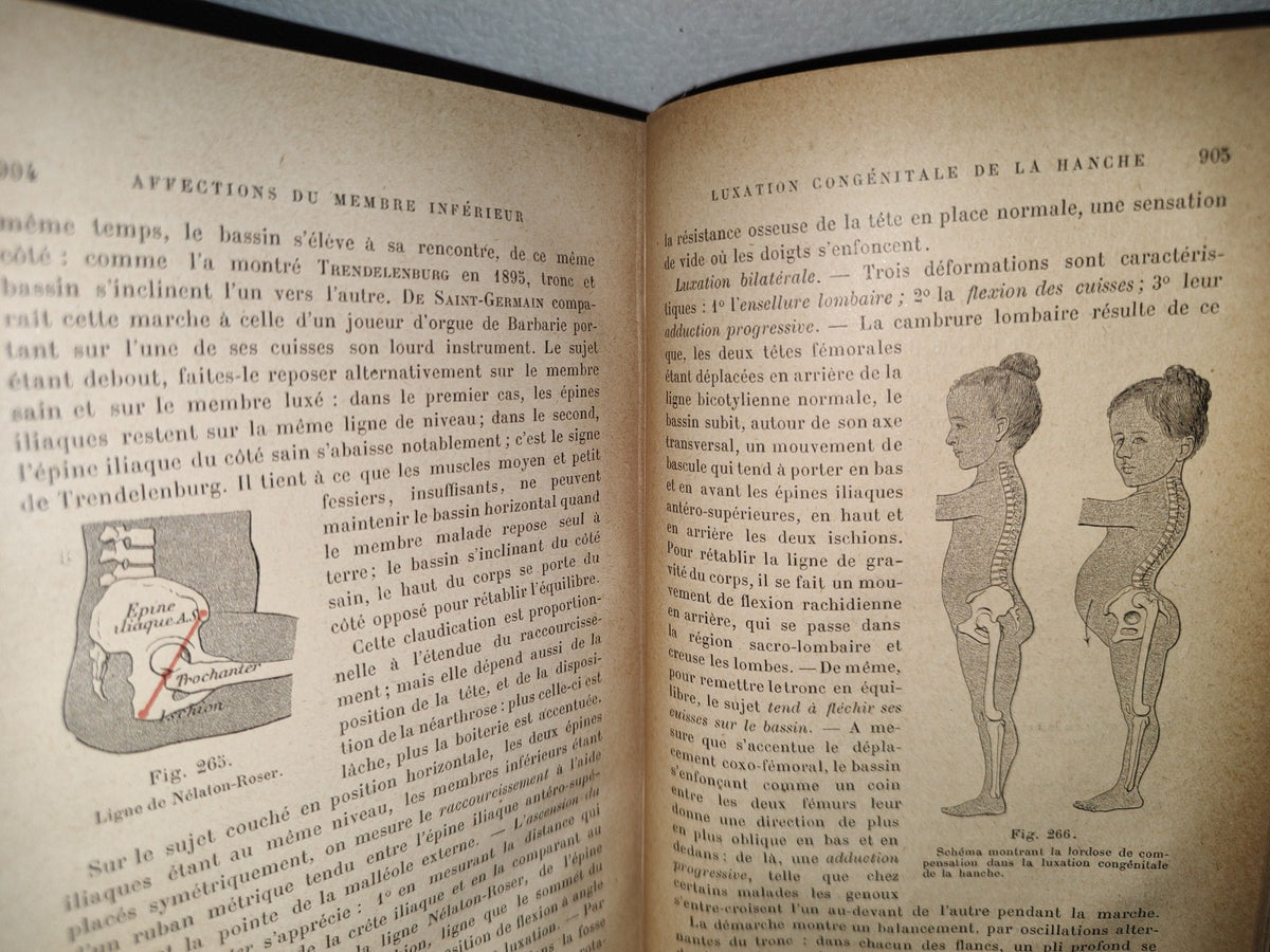59- Francés. Compendio De Patología / Précis De Pathologie Externe - E. Forgue - 1906