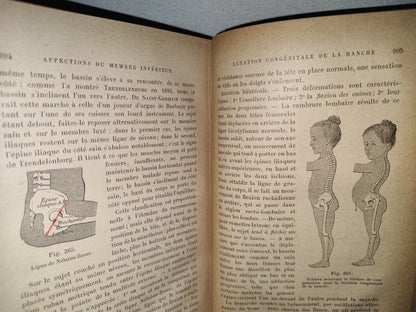 59- Francés. Compendio De Patología / Précis De Pathologie Externe - E. Forgue - 1906