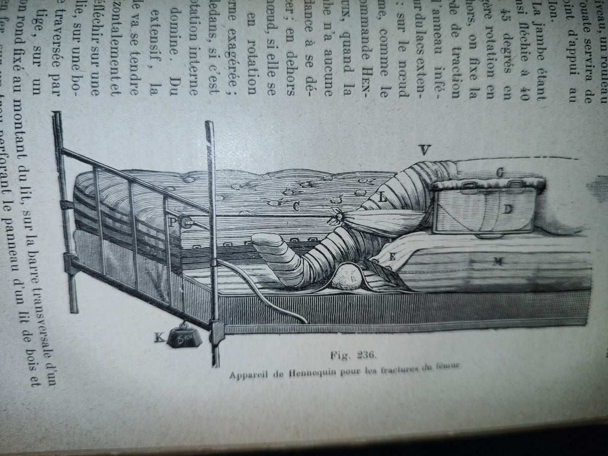 59- Francés. Compendio De Patología / Précis De Pathologie Externe - E. Forgue - 1906