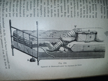 59- Francés. Compendio De Patología / Précis De Pathologie Externe - E. Forgue - 1906