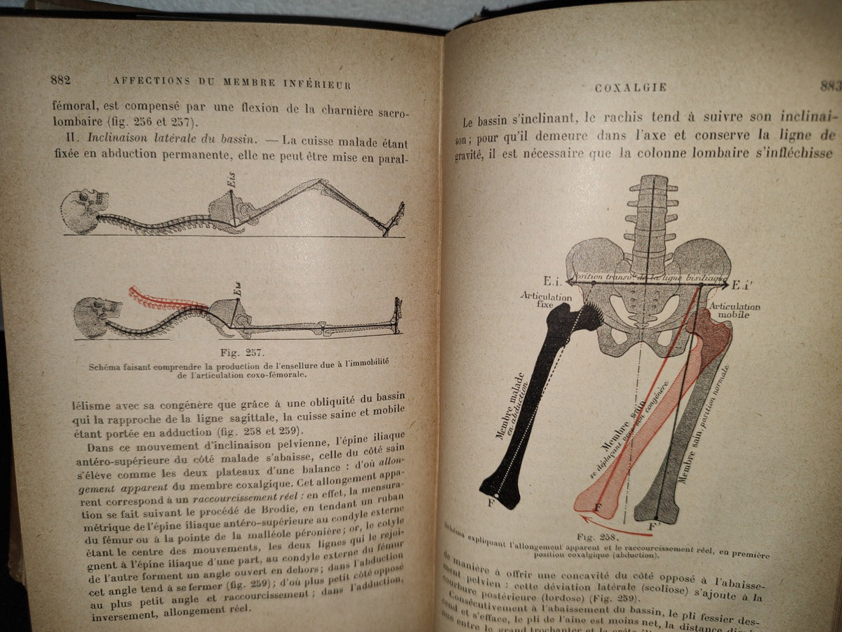 59- Francés. Compendio De Patología / Précis De Pathologie Externe - E. Forgue - 1906