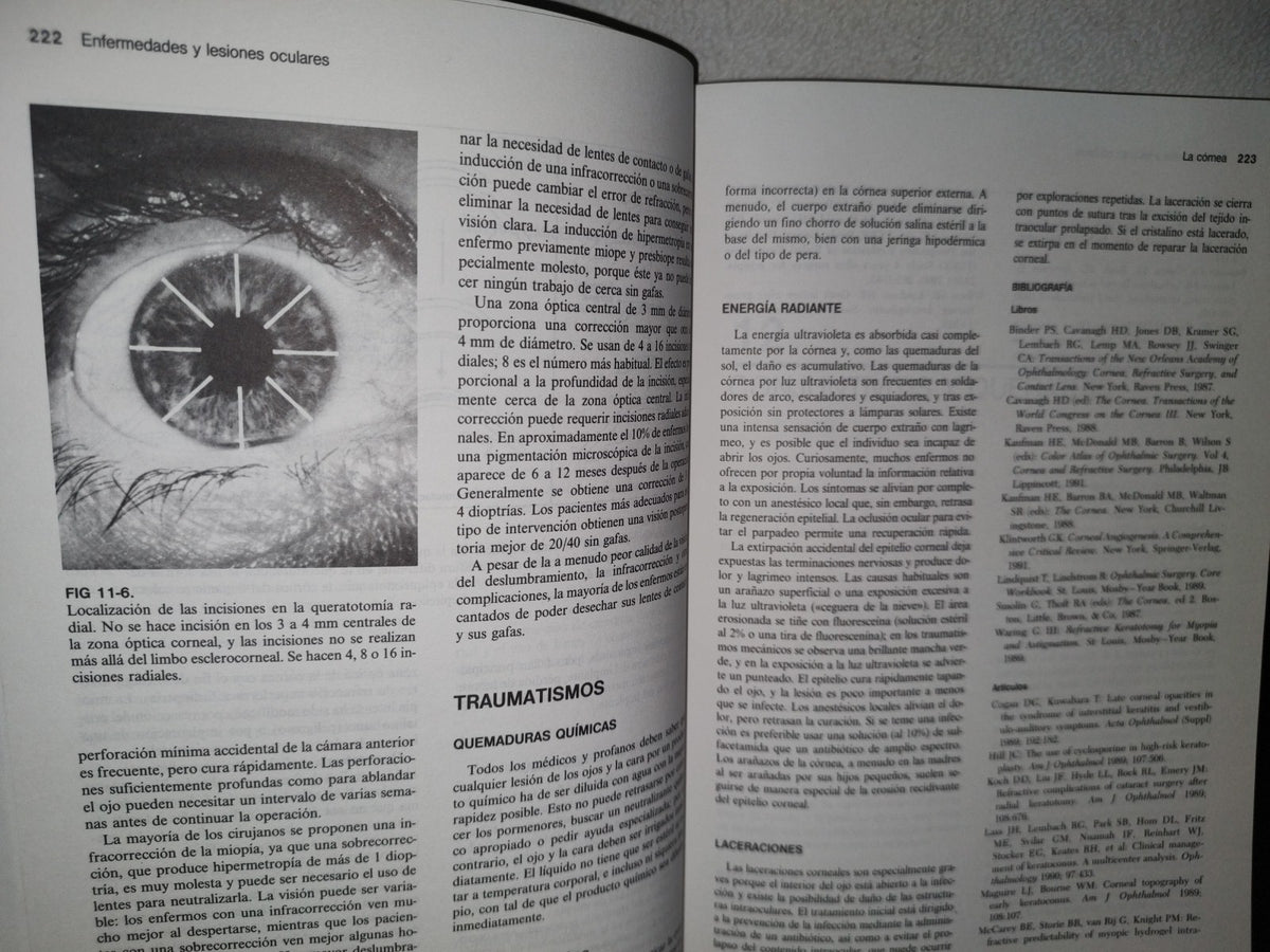 87-2- Oftalmología - Fundamentos Y Conceptos - Frank W. Newell - Séptima Edición 1993