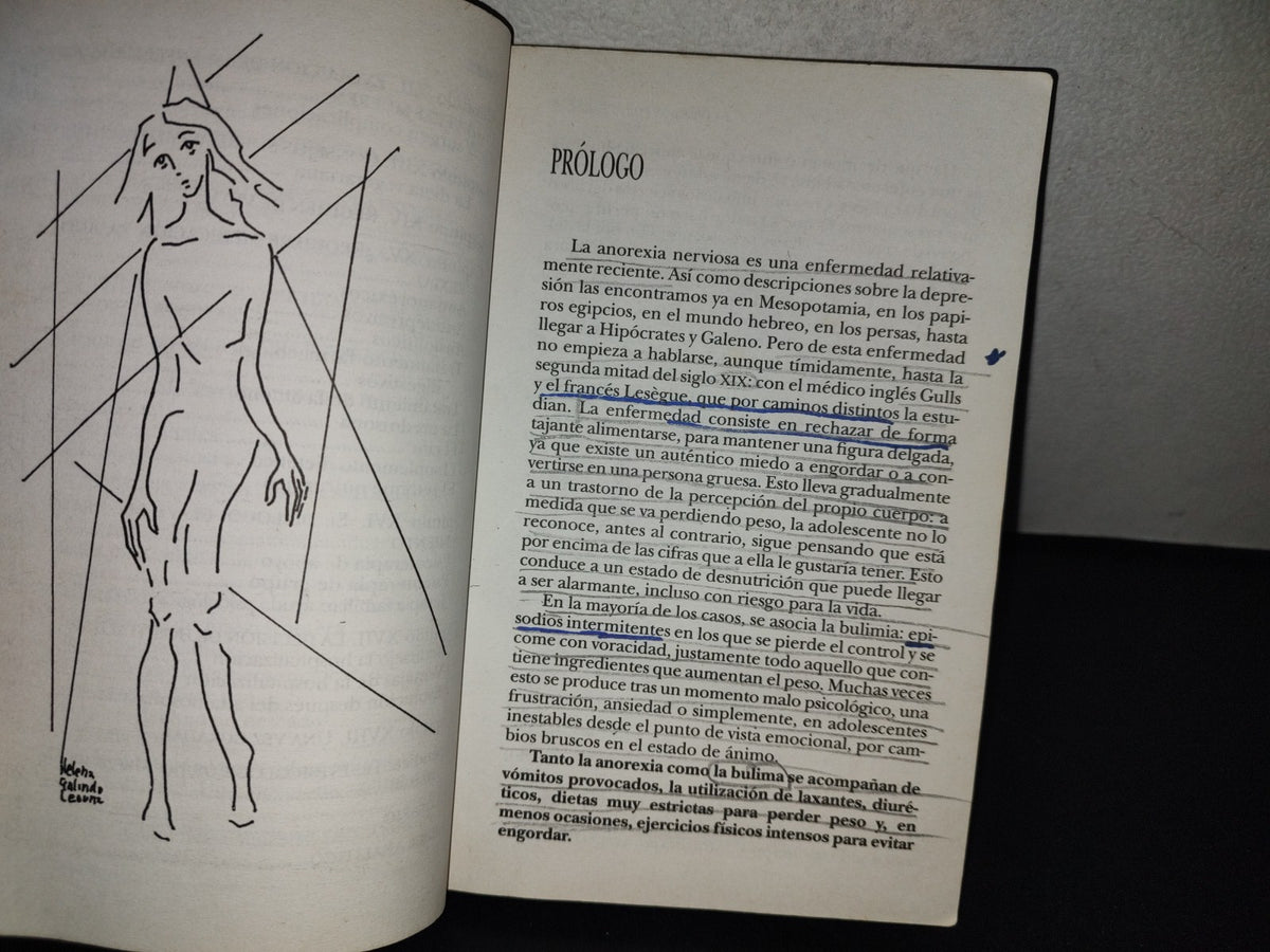 153- La Obsesión Por Adelgar. Bulimia Y Anorexia - Santiago Martínez-Fornés