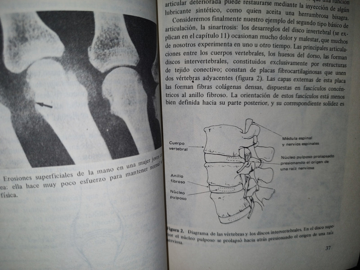 174- Qué Hay De Cierto Sobre La Artritis - J. T. Scott
