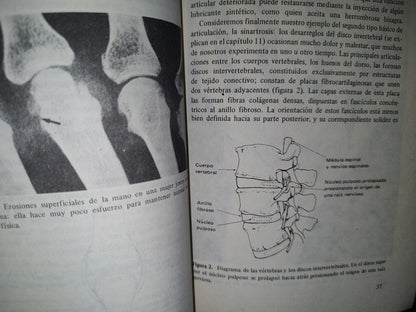 174- Qué Hay De Cierto Sobre La Artritis - J. T. Scott
