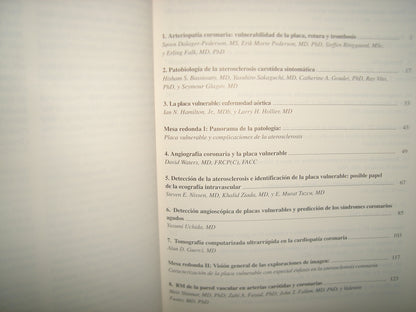 160- La Placa De Ateroma Vulnerable. Concepto, Identificación Y Modificación. Editor Valentín Fuster